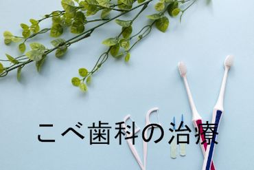 こべ歯科の治療